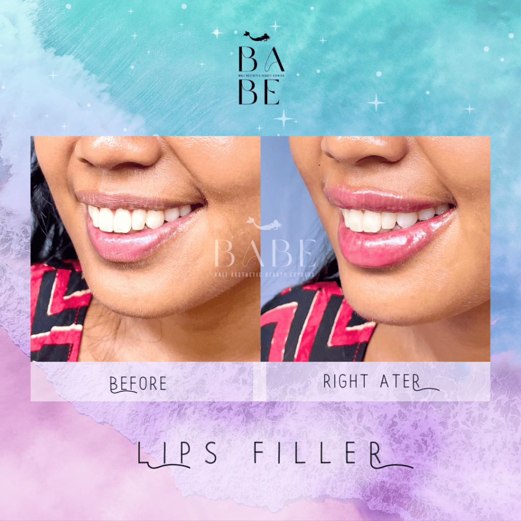 33 - babe-bali.co.id