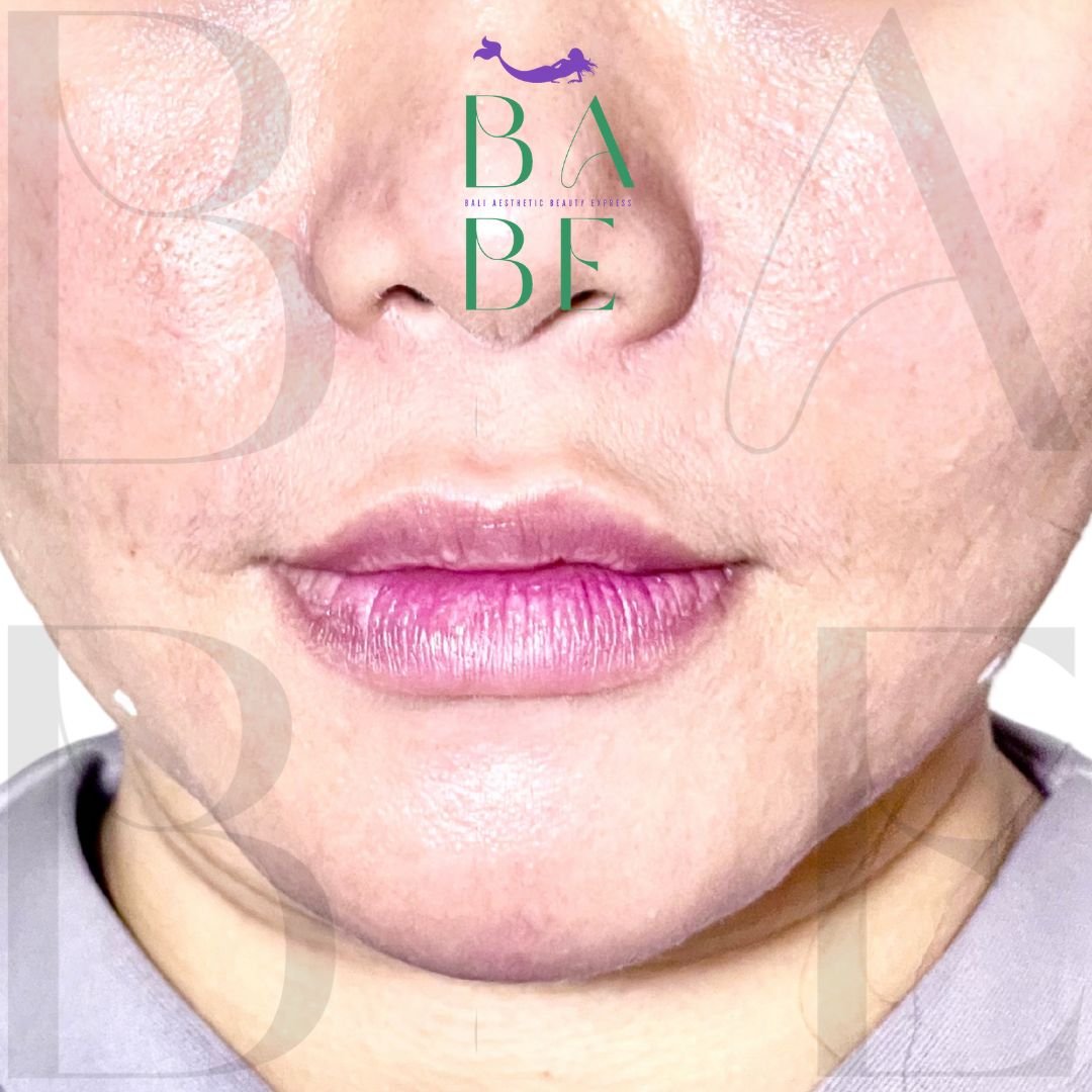 16 - babe-bali.co.id