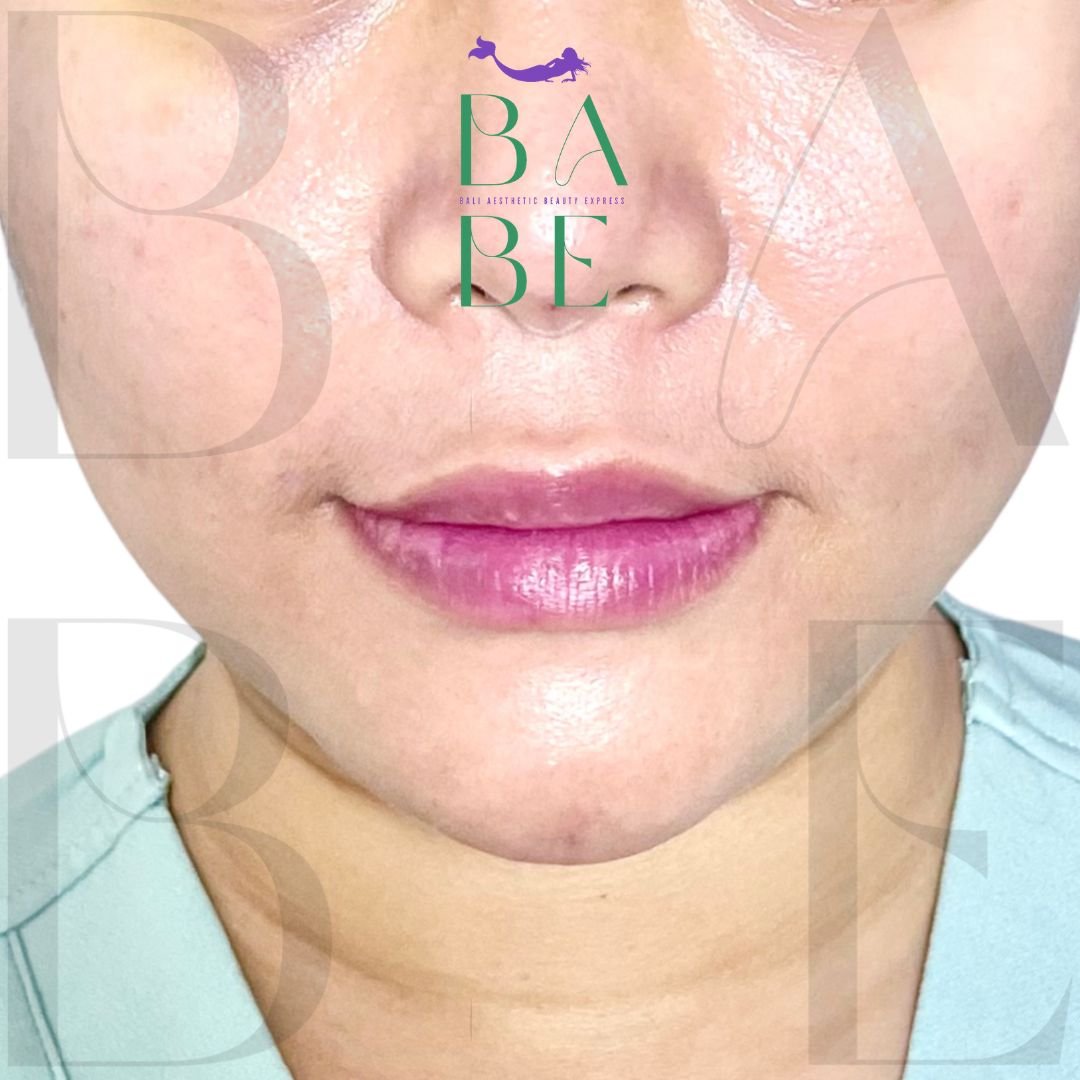 17 - babe-bali.co.id