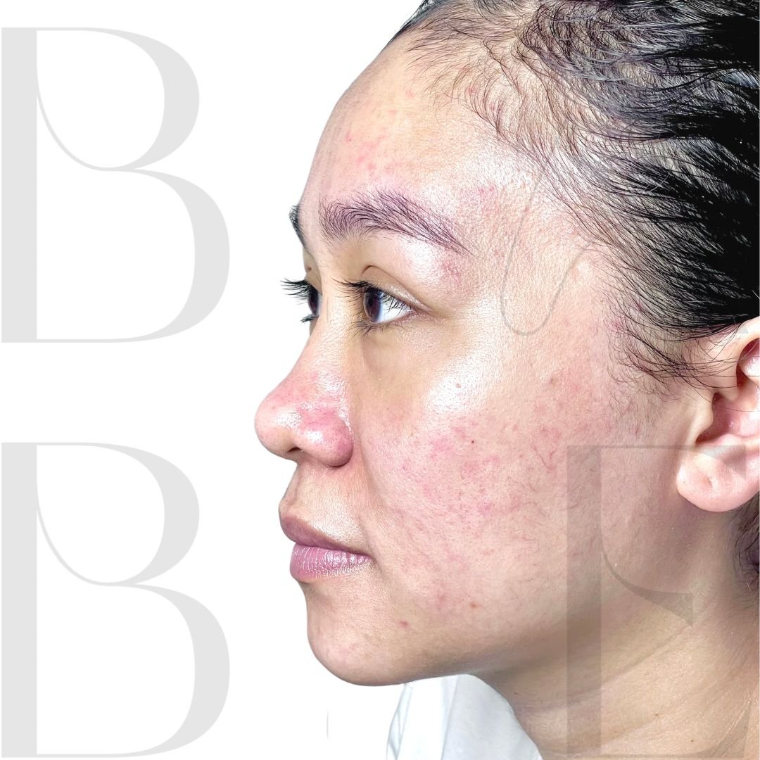 24 - babe-bali.co.id