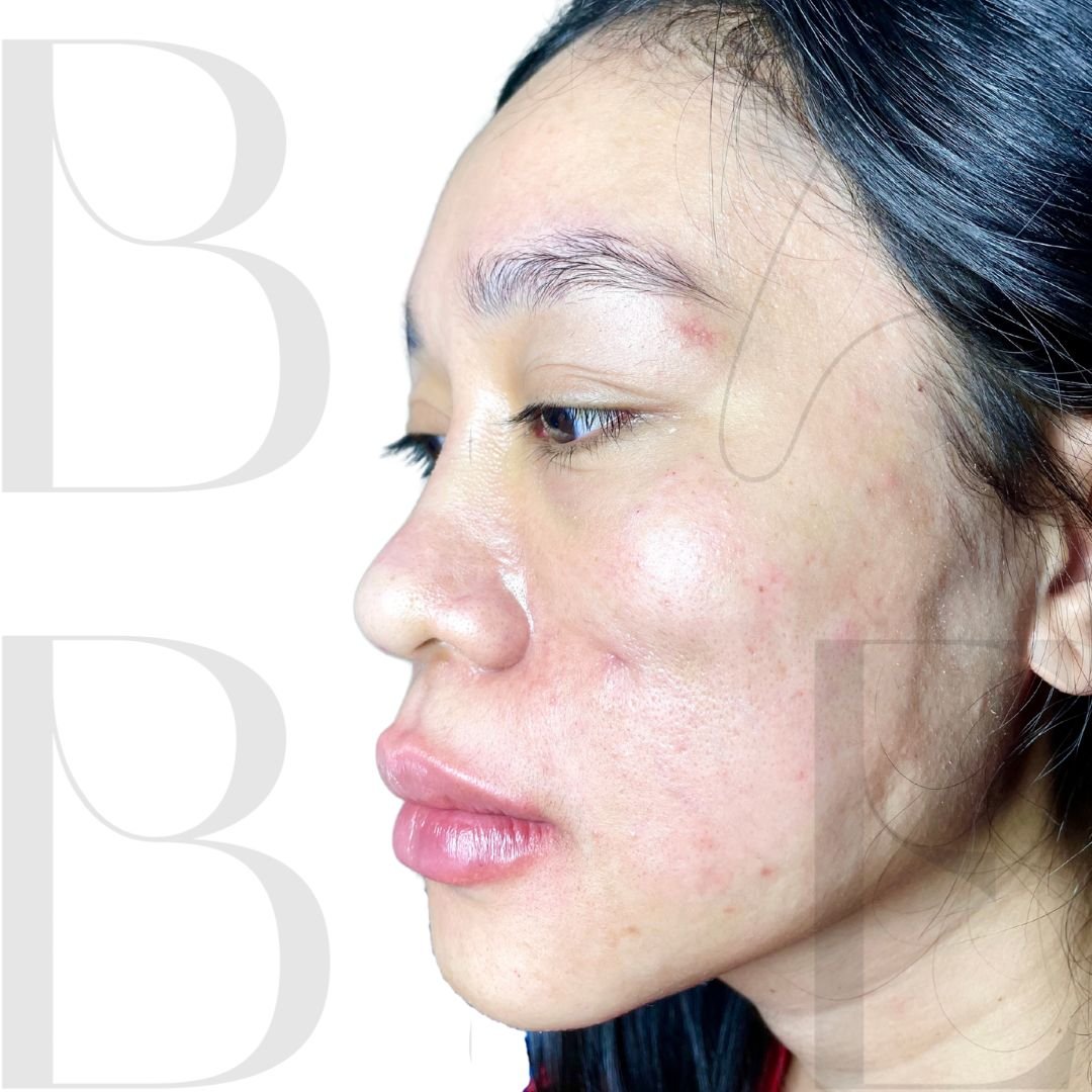25 - babe-bali.co.id