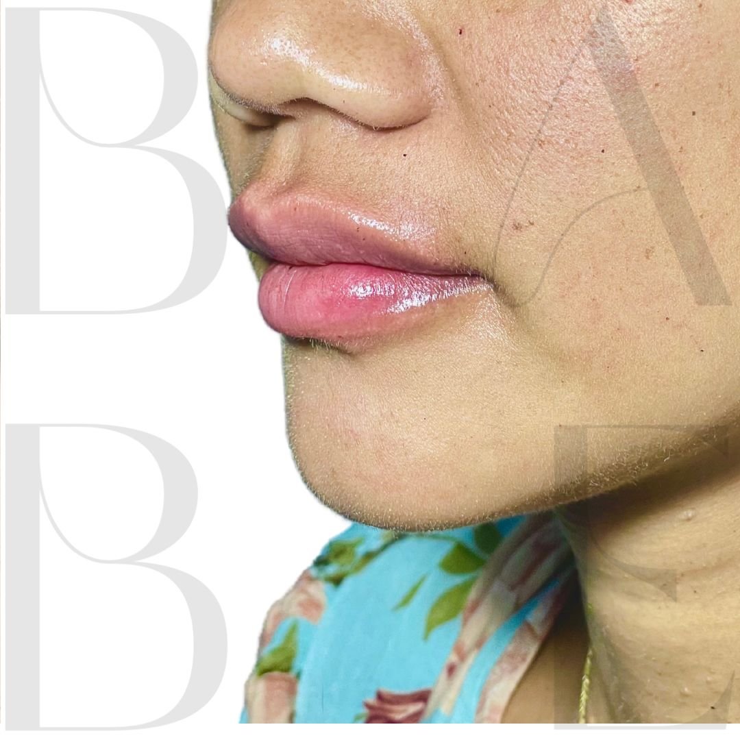 39 - babe-bali.co.id